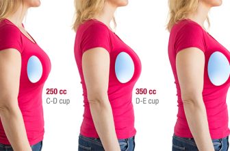 Breast Augmentation Surgery A Success