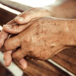 Age Spots vs. Sun Spots: What's the Difference?