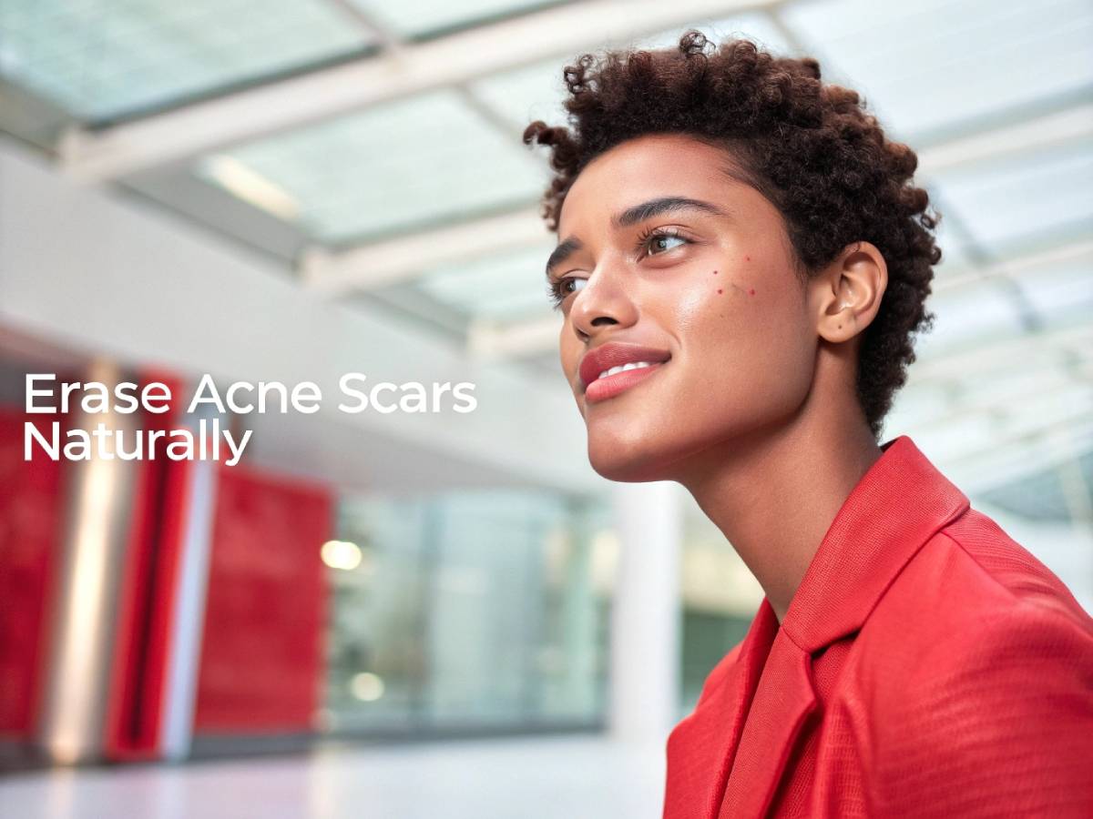Erase Acne Scars Naturally: Red Light Therapys Healing Power
