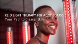 Does Red Light Therapy Help with Acne Scars?